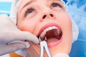 Когда следует удалить зуб: рекомендации всем пациентам