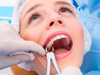 Когда следует удалить зуб: рекомендации всем пациентам